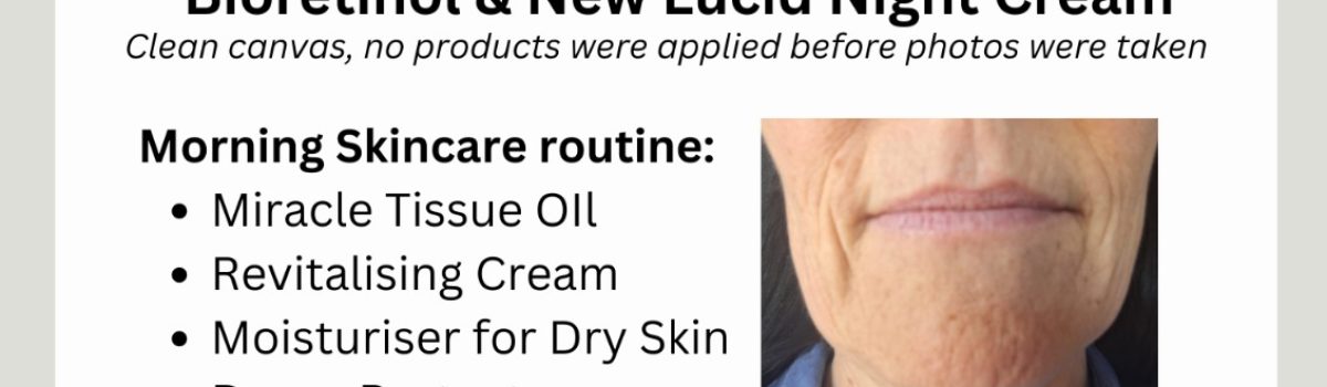 Testimonial Photo | Monika Basson Retinol and Lucid Night Cream with Hyaluronic Acid